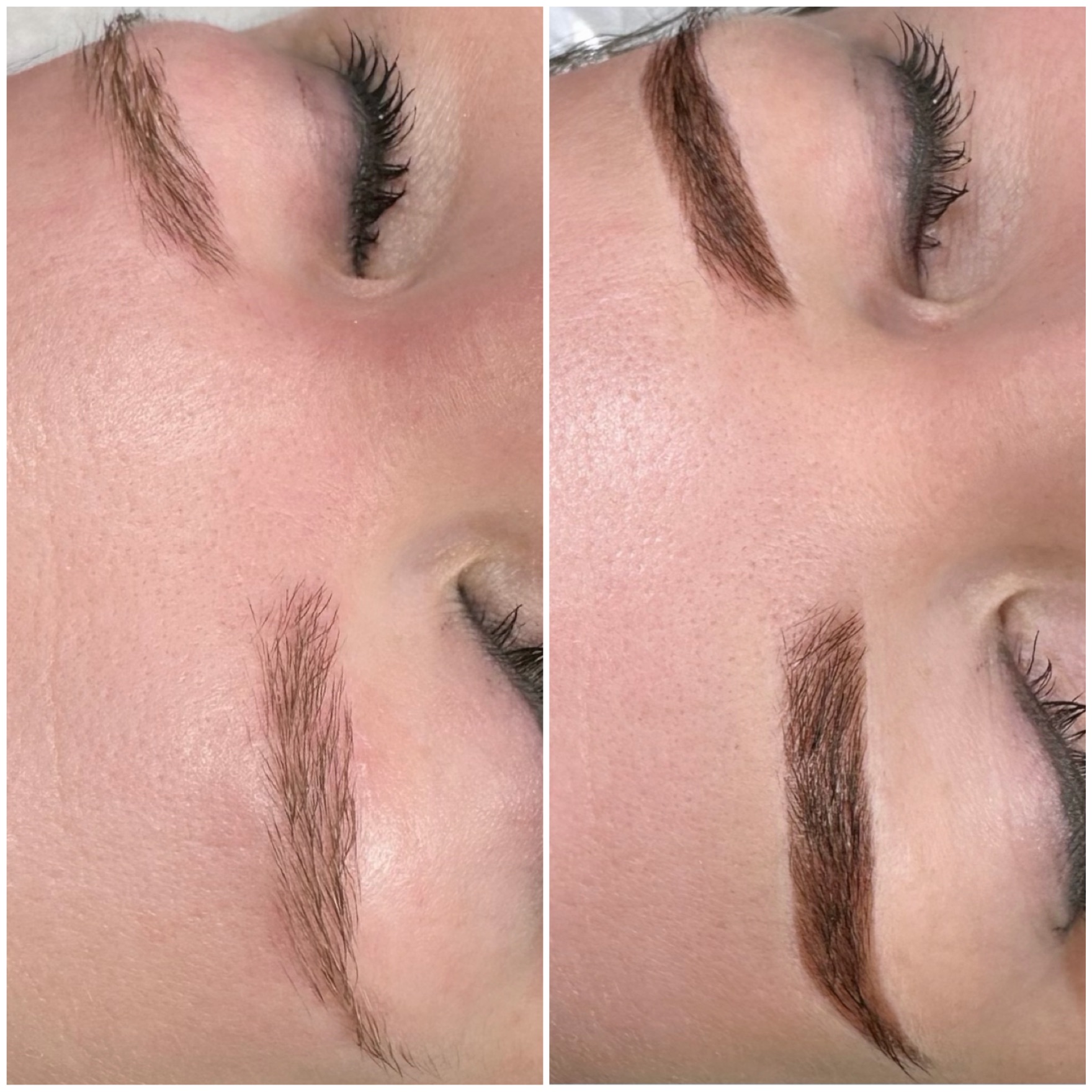 Brow treatment result